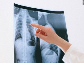 KINGSPORT DOCTOR HAS MEDICAL LICENSE REVOKED